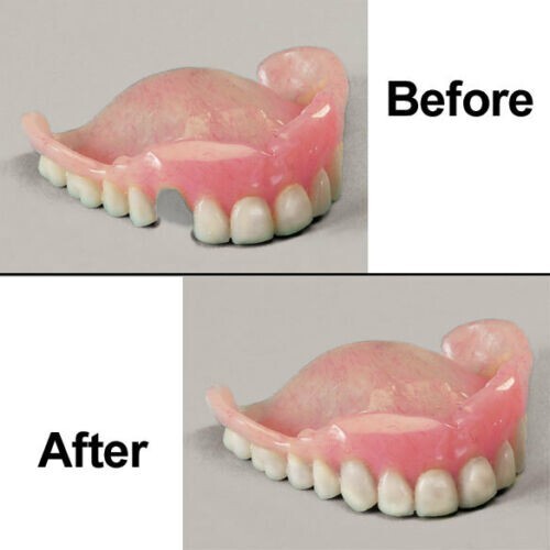 Temporary tooth repair kit - temporary,