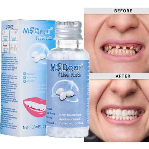 Kit fake teeth permanent - kit,