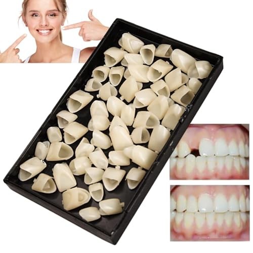 Temporary tooth replacement - temporary,