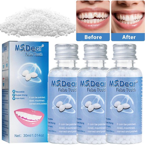 Tooth repair kit moldable - kit,