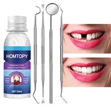 Tooth Repair Kit For Broken