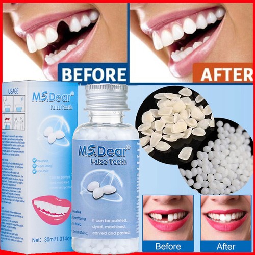 Temporary strong teeth tooth - temporary,