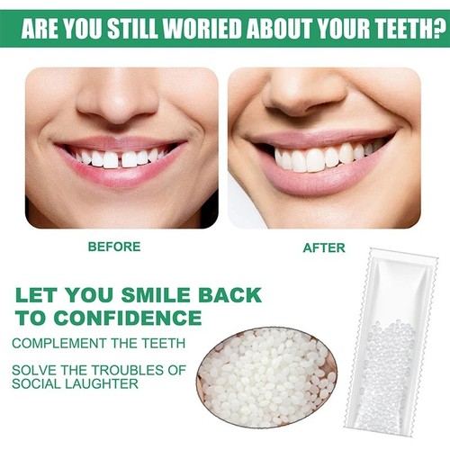 Temporary tooth repair kit - tooth,