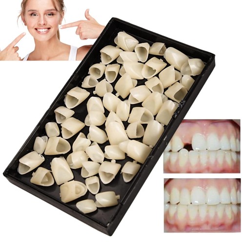 Temporary tooth replacement - temporary,