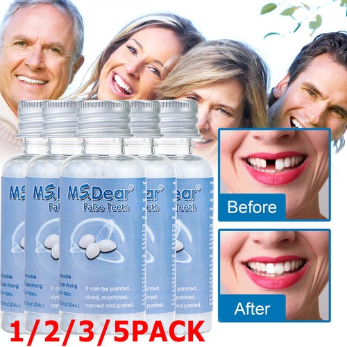 Tooth repair beads - tooth,