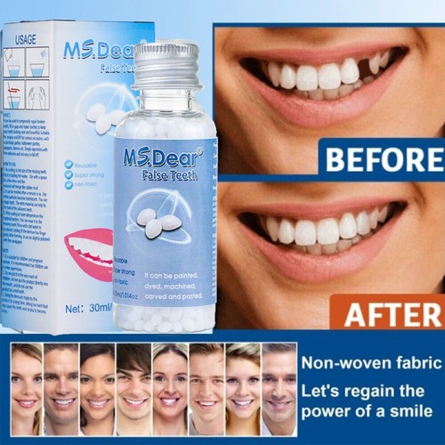 Temporary tooth repair kit - tooth,