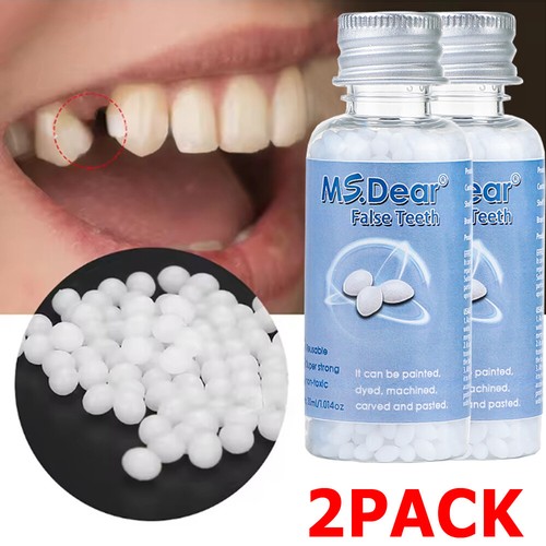 Temporary tooth repair kit - temporary,