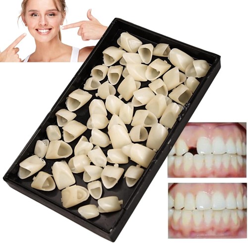 Temporary tooth replacement - tooth,