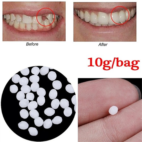 Tooth repair kit temporary - tooth,