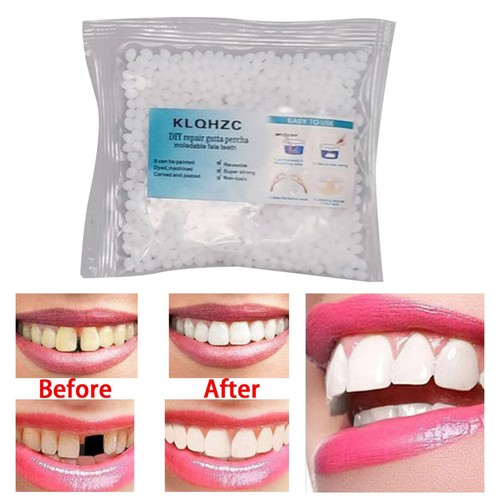 Temporary tooth repair kit 25g - temporary,