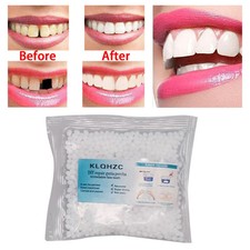 Temporary Tooth Repair Kit 25G