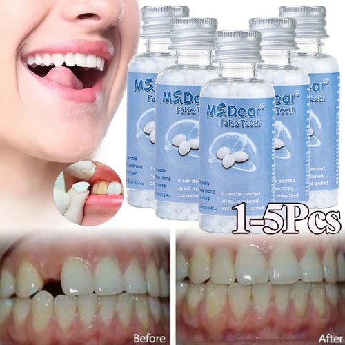 Temporary tooth repair - kit, fix