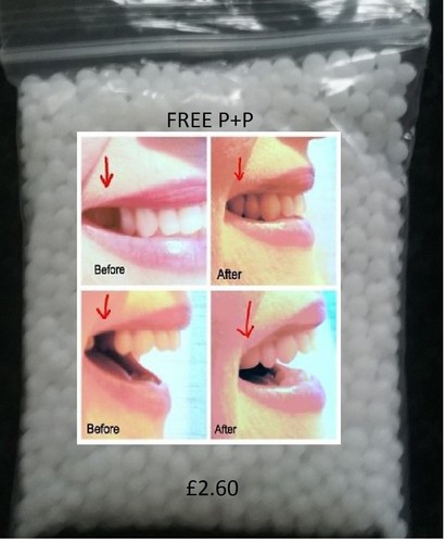 Temporary tooth repair kit - temporary,