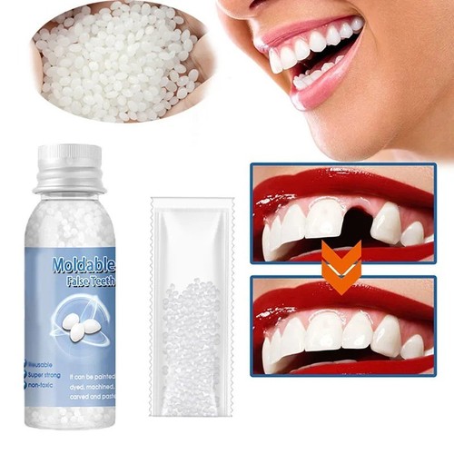 Temporary tooth repair kit - temporary,