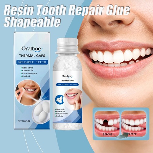 Tooth repair kit temporary - tooth,