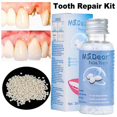 Temporary tooth repair kit - tooth,