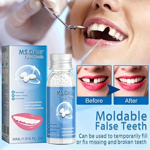 Temporary tooth repair kit - temporary, fix