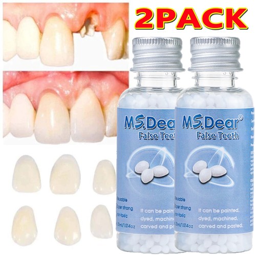 Tooth repair granules - repair,