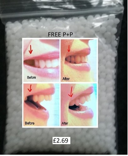 Temporary tooth repair kit fix - repair,