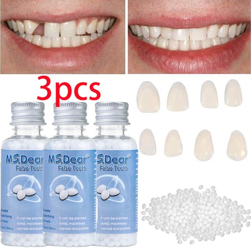 Tooth repair granules - 3x,