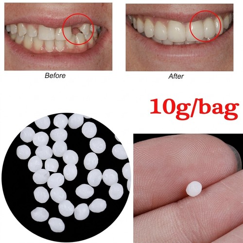 50g bag tooth repair - bag,