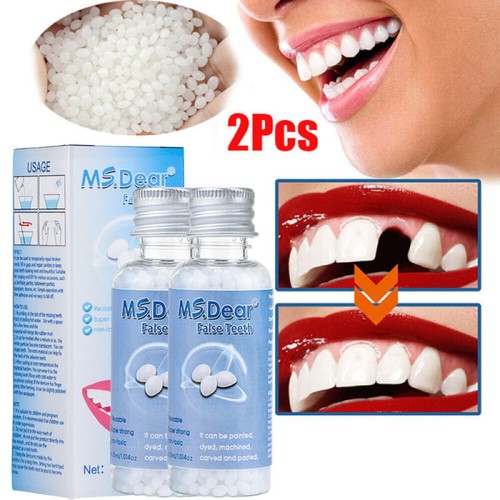 Temporary tooth repair kit - 2x,