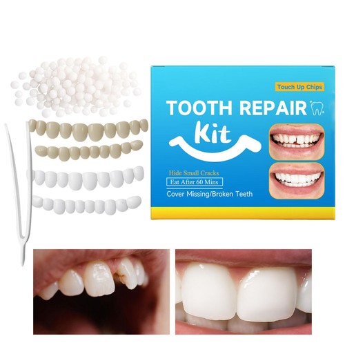 Temporary tooth repair kit - tooth,