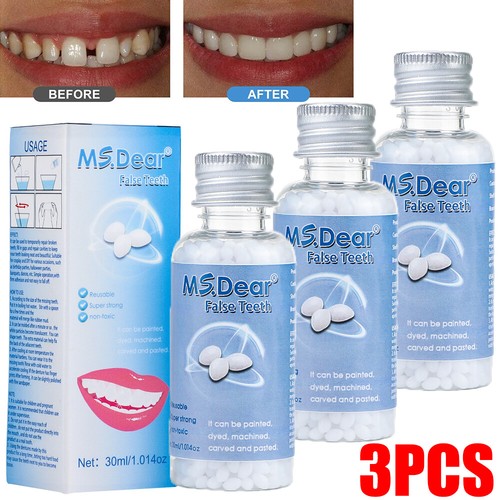Moldable tooth repair - moldable,