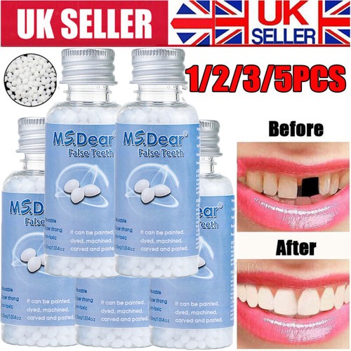 Temporary tooth repair - tooth,