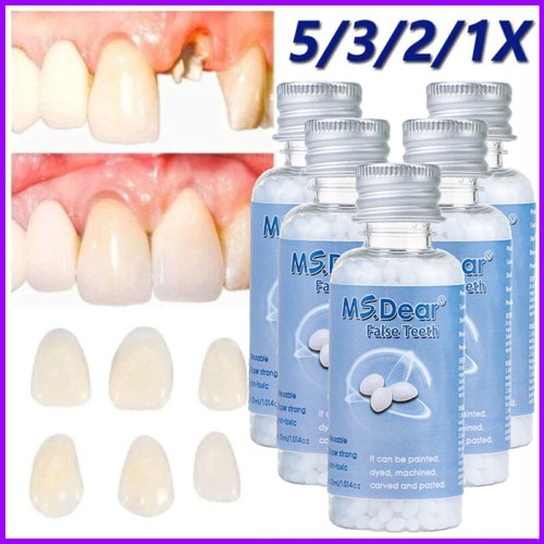 Tooth repair granules - 5/3x,